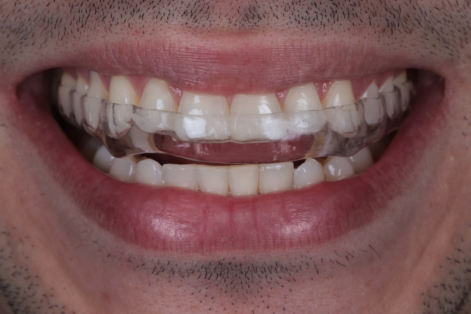 Descrição da imagem